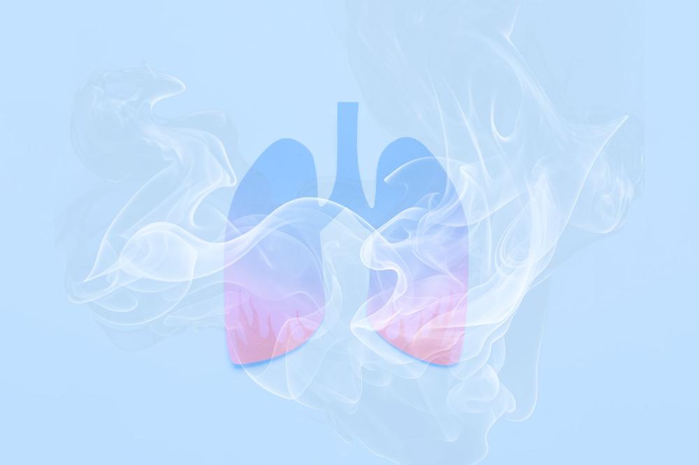 EVALI — болезнь вейперов и любителей электронных сигарет